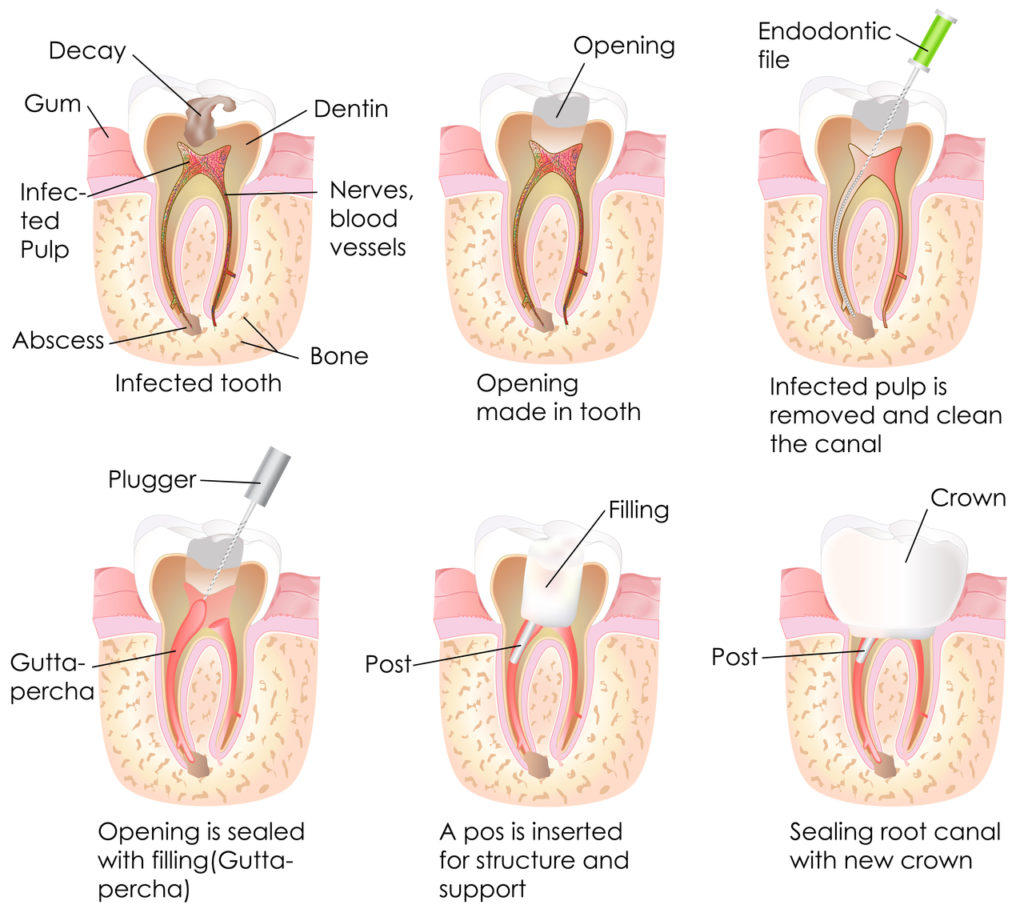 What Pregnant Mums Need To Know About Toothache Lemon Film